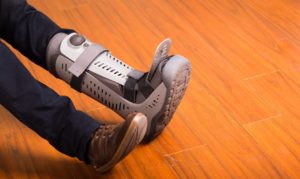 Man with injured leg in Lafayette LA