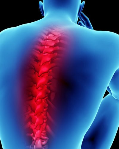 Effective Treatments for Chronic Back Pain After an Accident