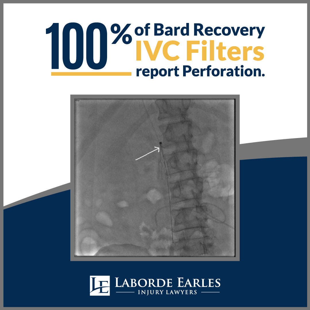 IVC Filters Safety Concerns Laborde Earles Injury Lawyers