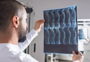 Laborde Earles Law Firm - Opelousas Spinal Cord Injury Lawyer Opelousas Spinal Cord Injury Lawyer