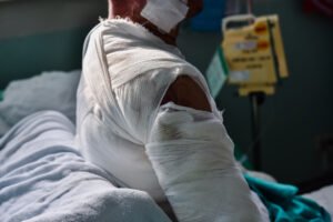How to File a Lawsuit if You Suffer Burn Injuries in an Accident